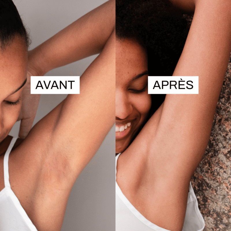 pack-le-grand-donateur-endro-cosmetiques-deodorant-7220848.png pack-le-grand-donateur-endro-cosmetiques-deodorant-7220848.png